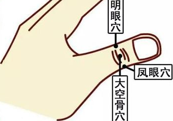 長時(shí)間看手機(jī)眼花怎么辦，不急，自己按摩三步就可以解決！