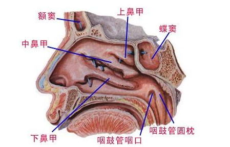 鼻竇氣壓性創傷示意圖
