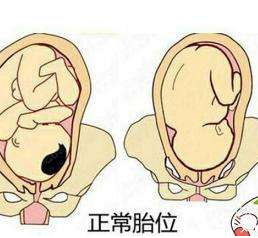 中醫(yī)教你如何按摩至陰穴矯正胎位？