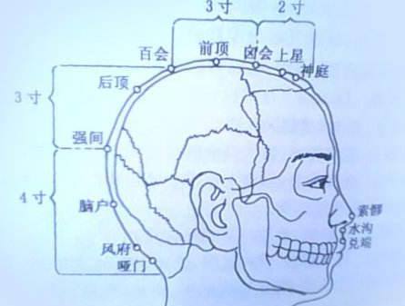 強間穴的刺灸法