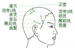 經(jīng)常按摩通天穴遠(yuǎn)離鼻炎鼻塞！通天穴的按摩方法