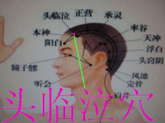 頭臨泣穴疏通鼻塞的按摩方法及其頭臨泣穴準(zhǔn)確位置圖解！