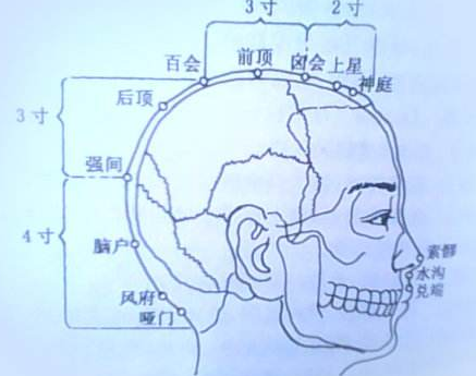 囟會穴示意圖