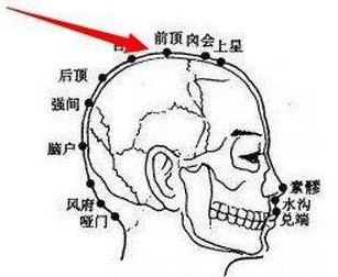 囟會穴位位置