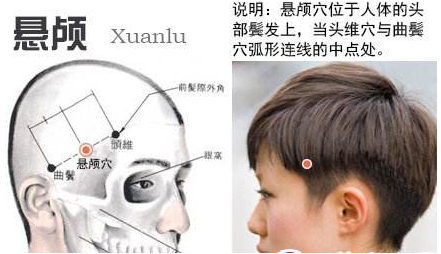 懸顱穴示意圖
