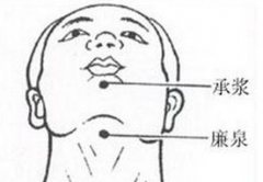 揪痧治療急性咽炎的方法