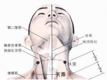 天鼎穴示意圖