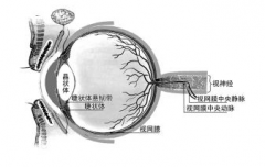 晶狀體脫位的發(fā)病原因及其治療方法有哪些？