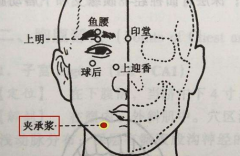 中醫夾針灸承漿穴治療三