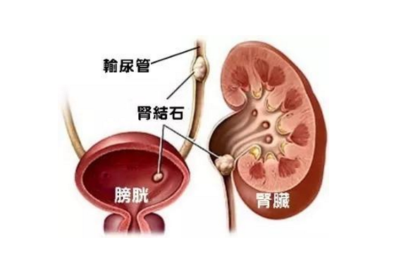 腎病患者的飲食調養