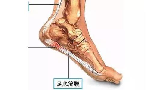 足底三角，不能穿高跟鞋最好別穿！
