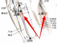 中醫(yī)針刺上廉穴治療踝關扭傷的方法及其上廉穴的準確位置！