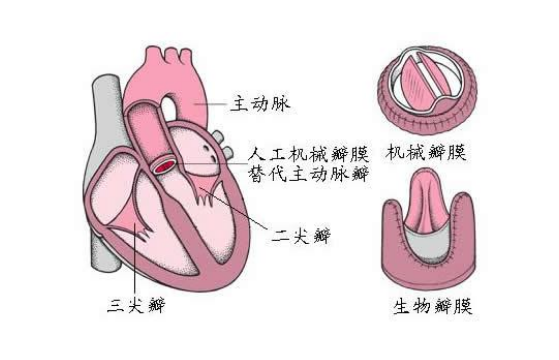 肺動(dòng)脈發(fā)育不全的預(yù)防