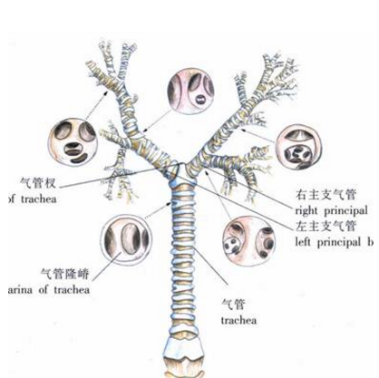 肺絡張如何鑒別？它的癥狀表現及其治療方法有哪些？